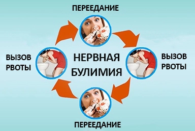 Лечение булимии в Залесово